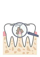 치과, 구강검진 대표사진