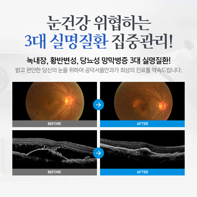 공덕안과의원 대표 이미지