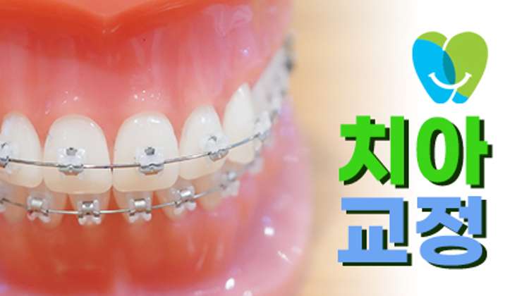 치아교정 대표사진