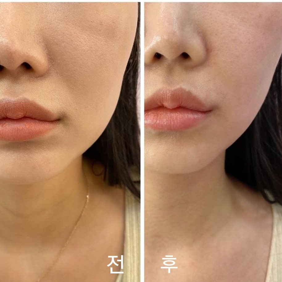 제주피부관리 더베러 대표 이미지