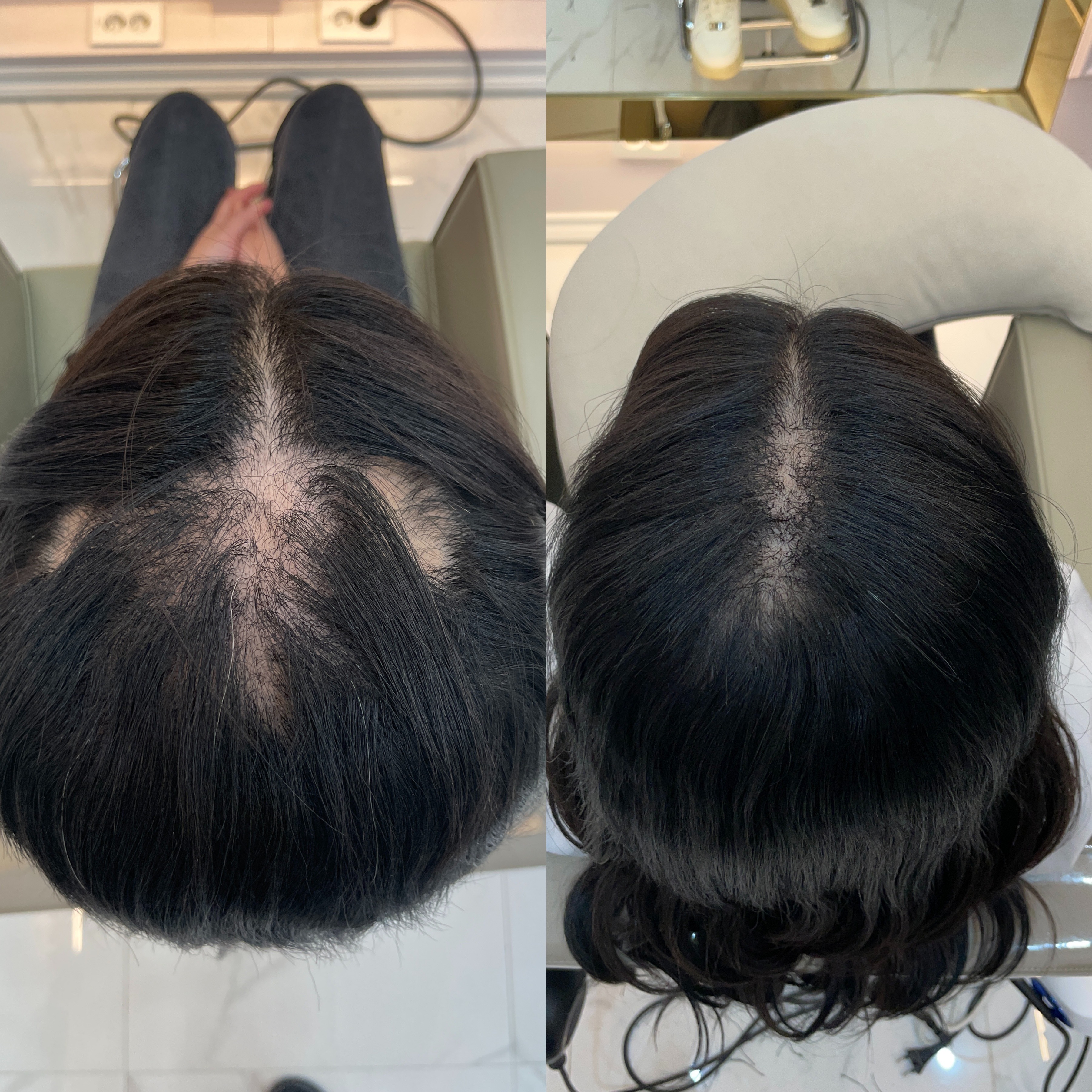 프레야 헤어증모&붙임머리 대표 이미지