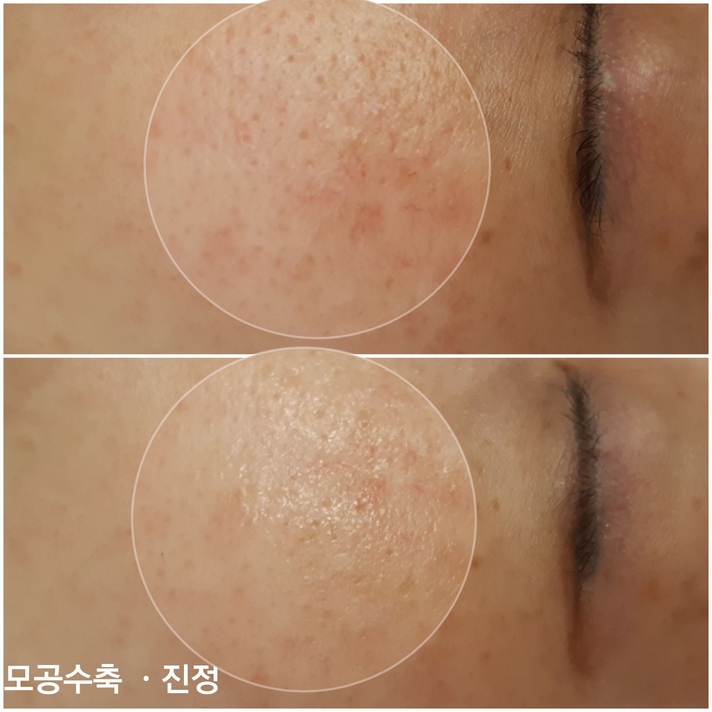 AR 민낯 연구소