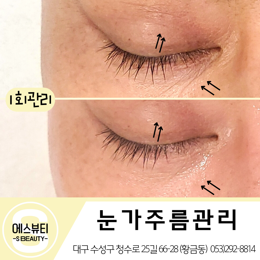 에스뷰티