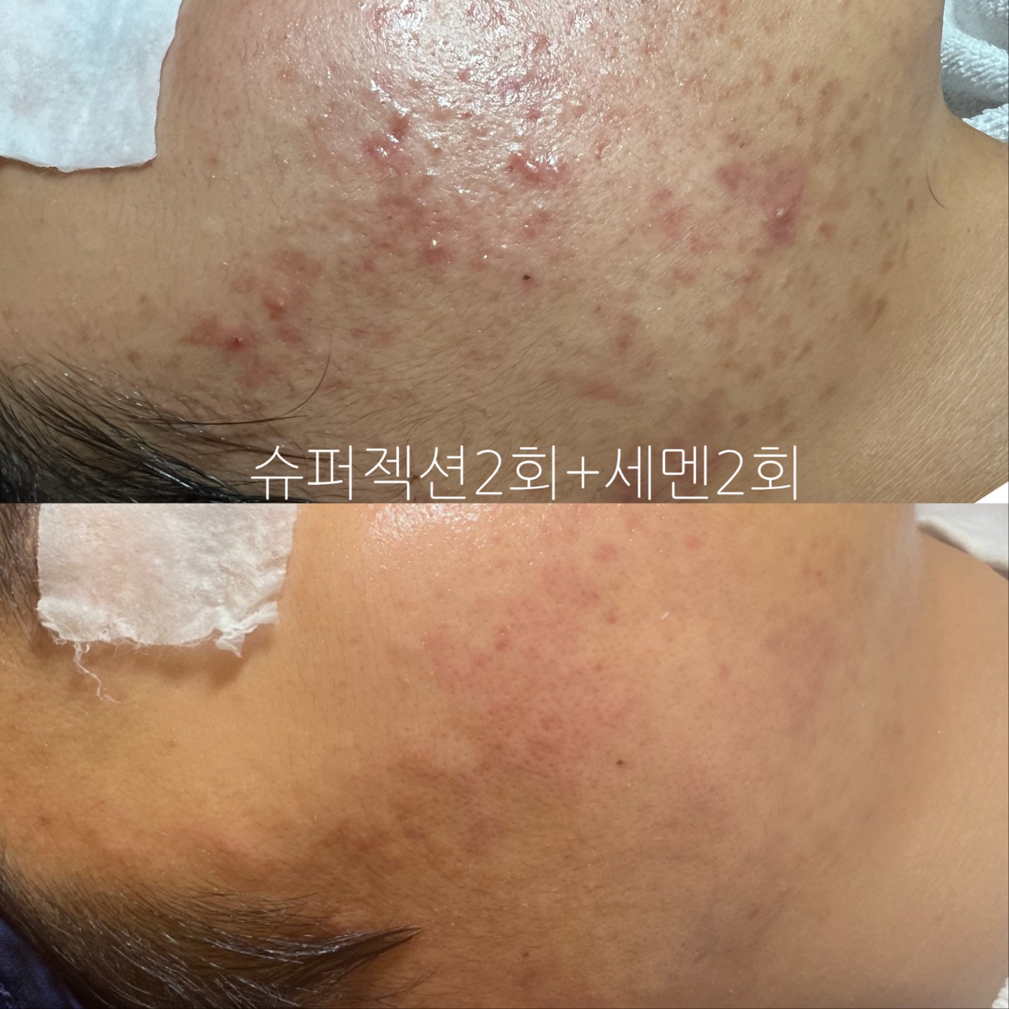 수이즈스튜디오 피부관리
