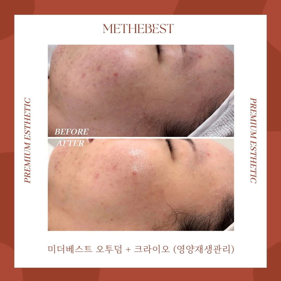 미더베스트 수원점