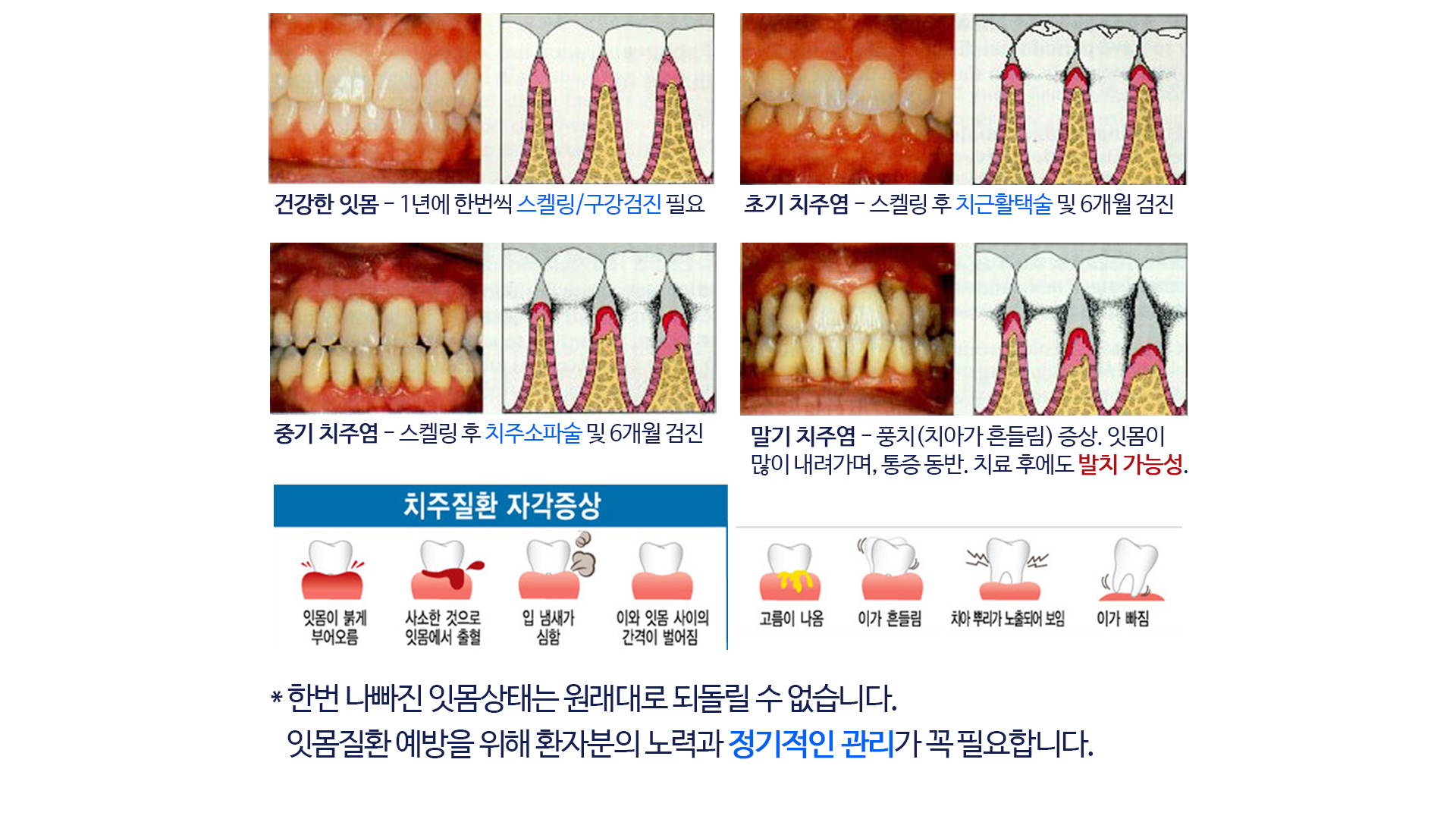 찬스플란트치과의원