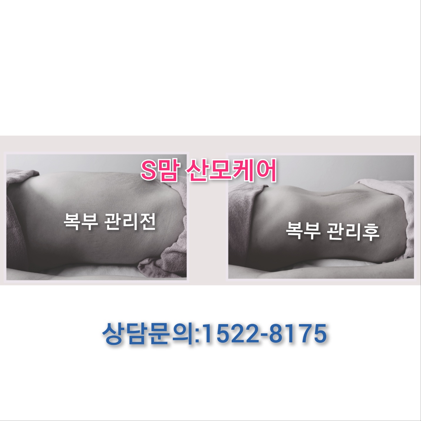 미소진S맘케어 photo 10