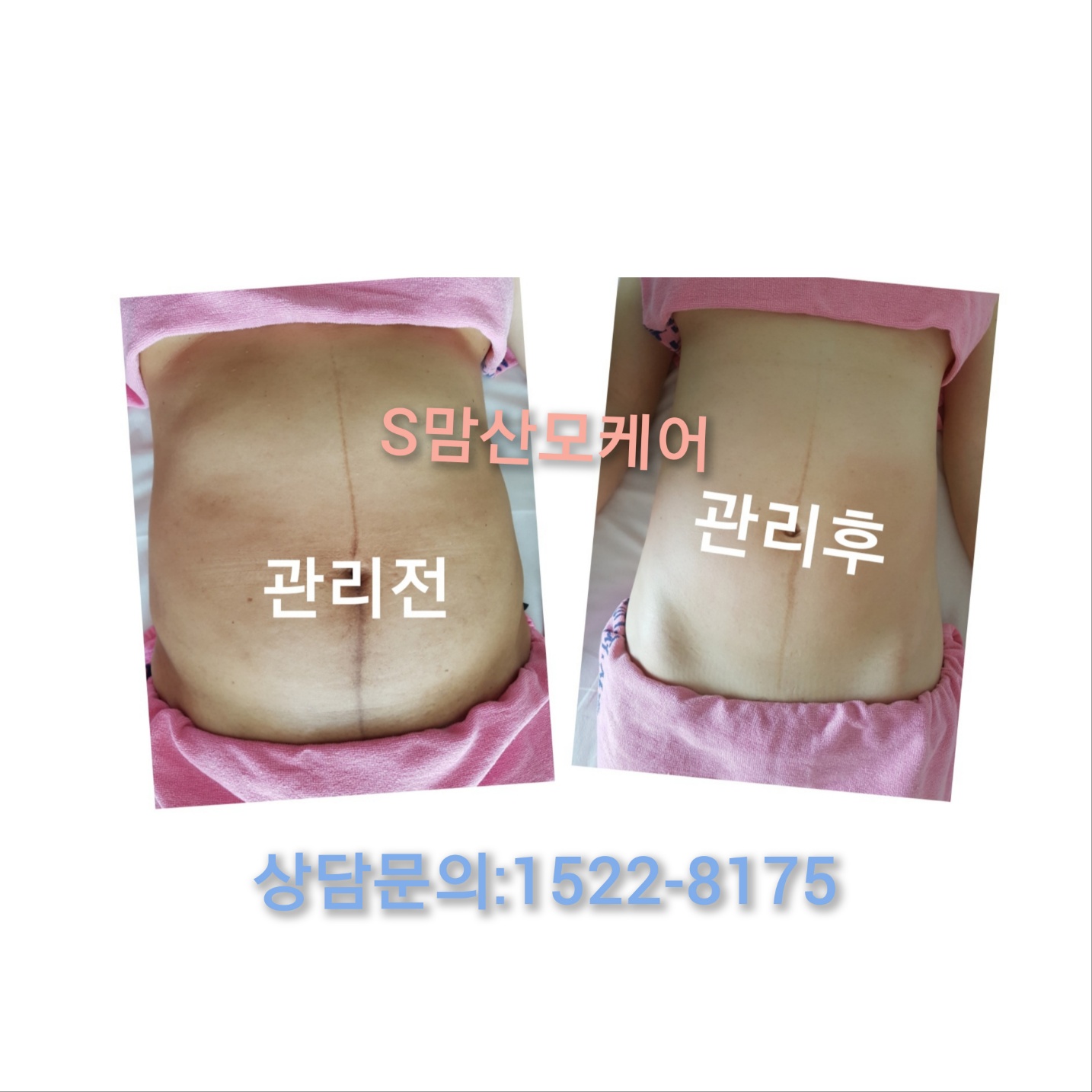 미소진S맘케어 photo 9