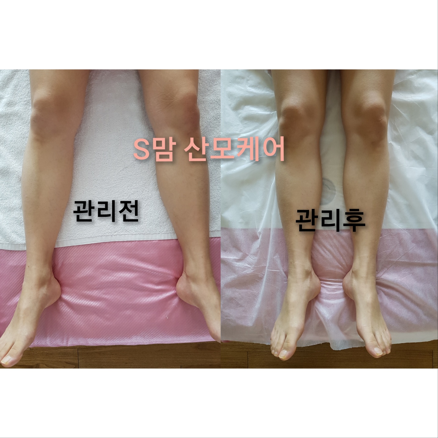 S맘산모케어
