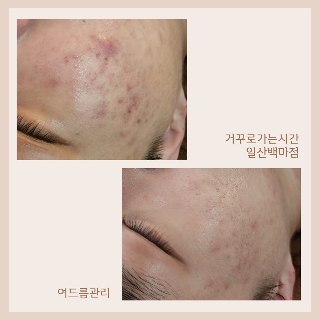 웰레스테틱 일산점