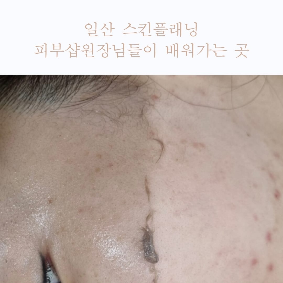웰레스테틱 일산점