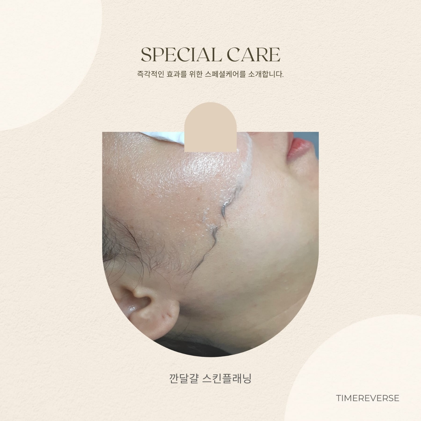 웰레스테틱 일산점
