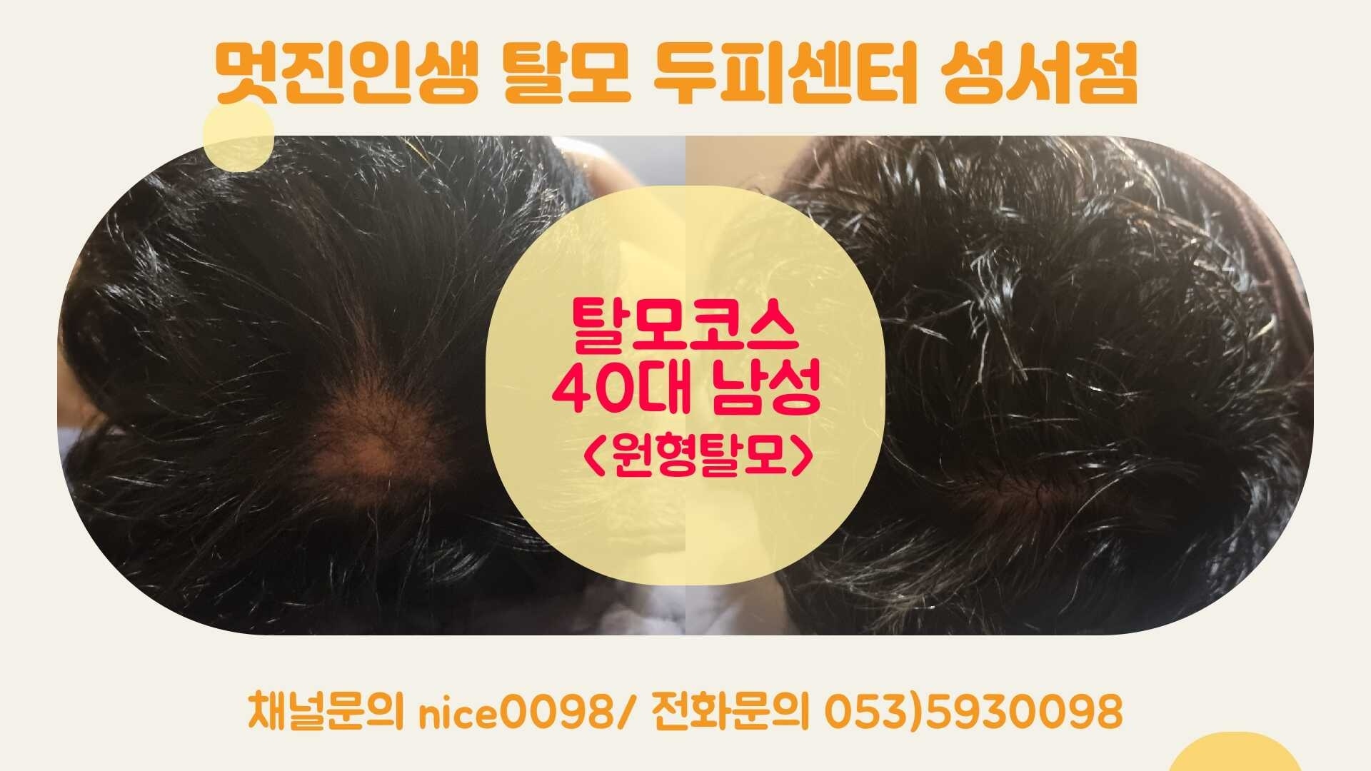 대구두피전문 각질관리 뷰티에스테틱을 다녀왔습니다. 3