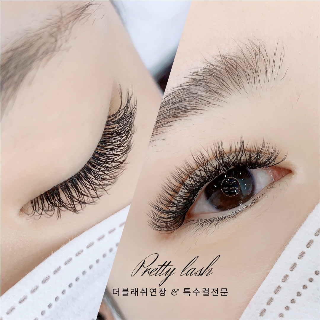 눈이 예쁘다 대표 이미지