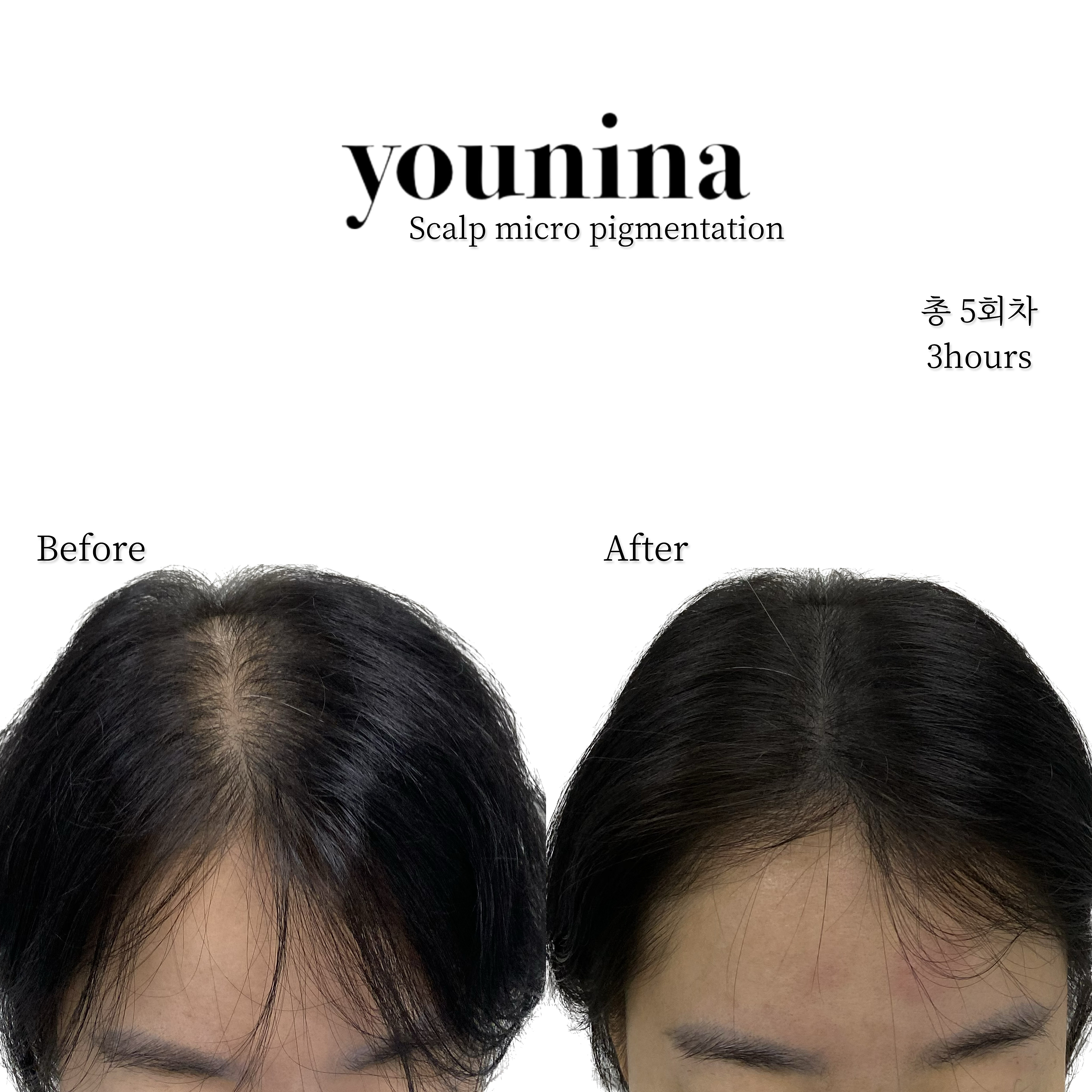 유니나뷰티&도트