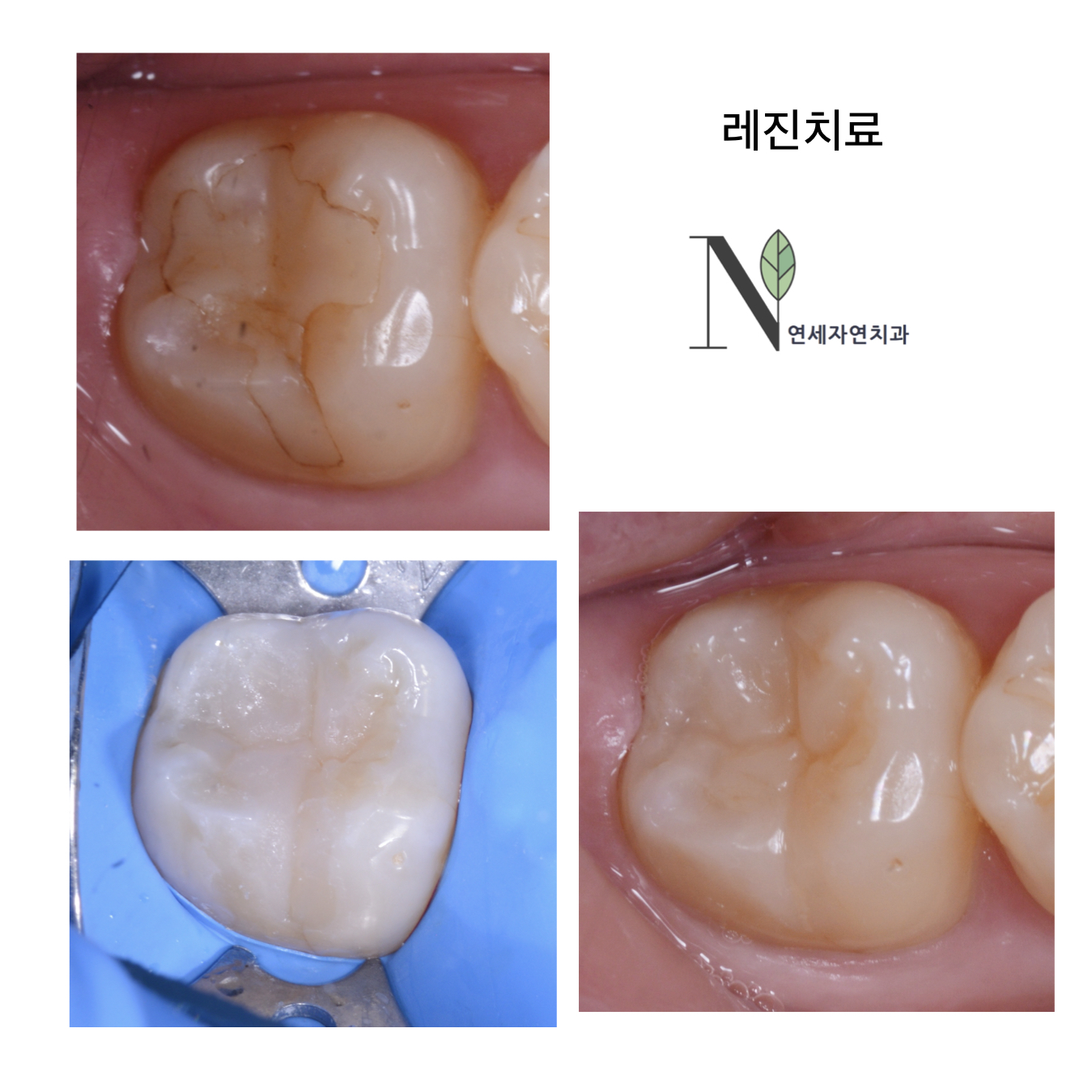 연세자연치과의원 대표 이미지