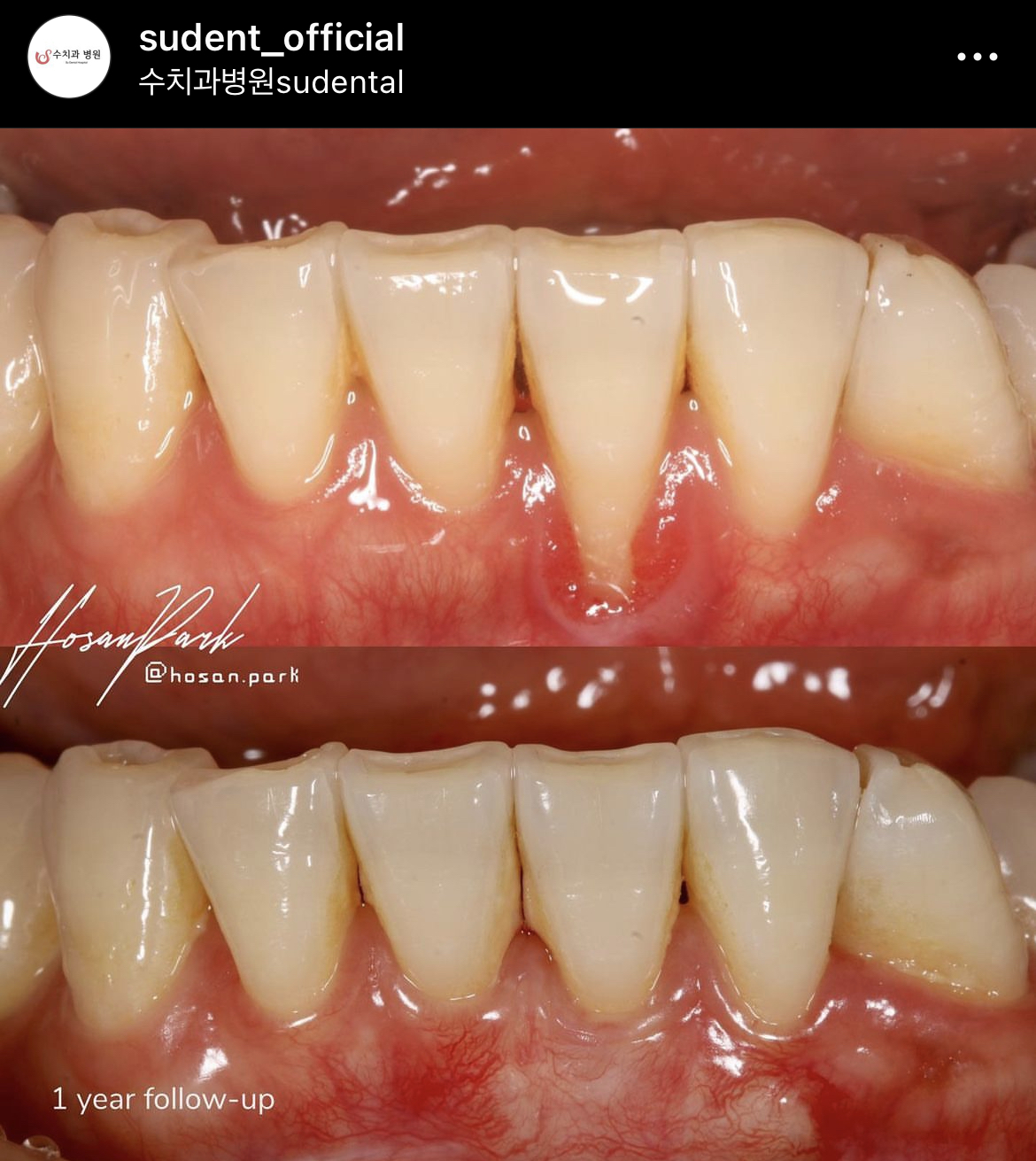 수치과병원 대표 이미지