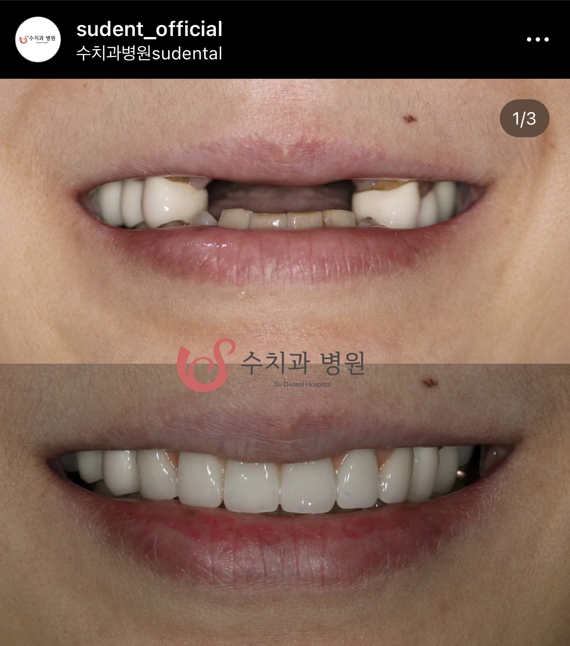 수치과병원 대표 이미지