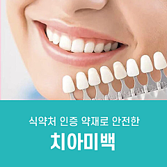 치아 미백 대표사진