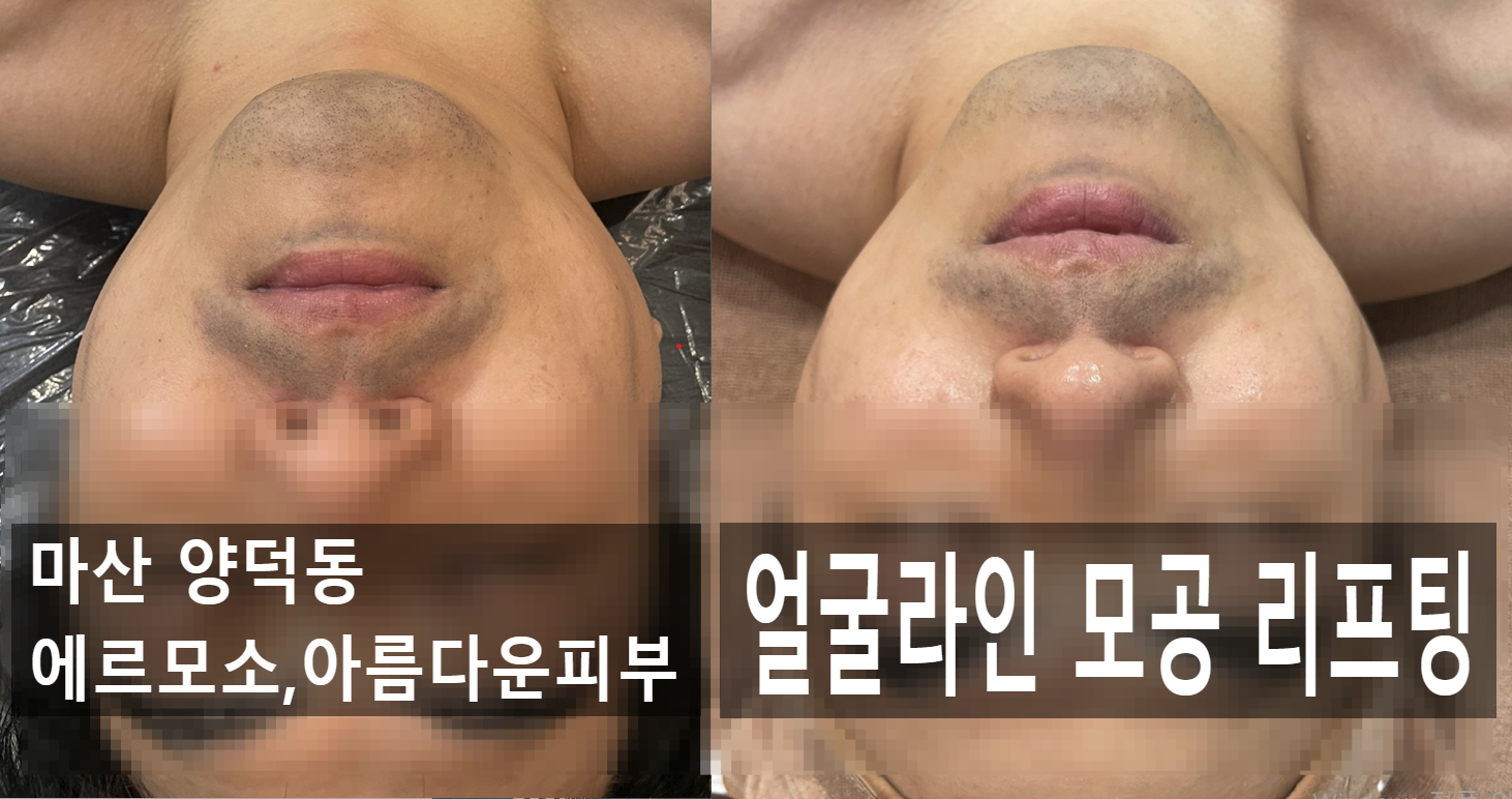 에르모소, 아름다운피부 photo 3