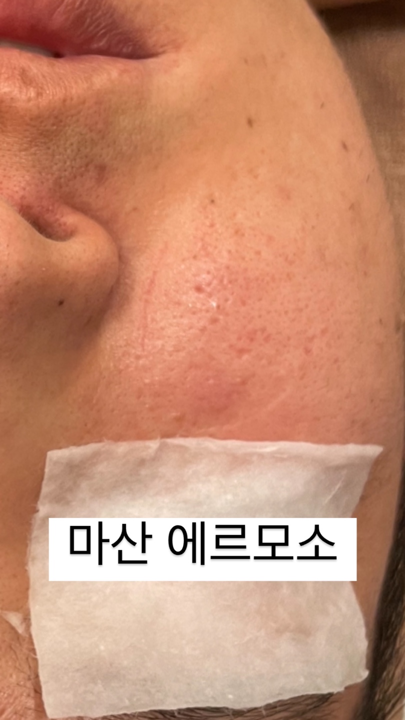 에르모소, 아름다운피부 photo 9
