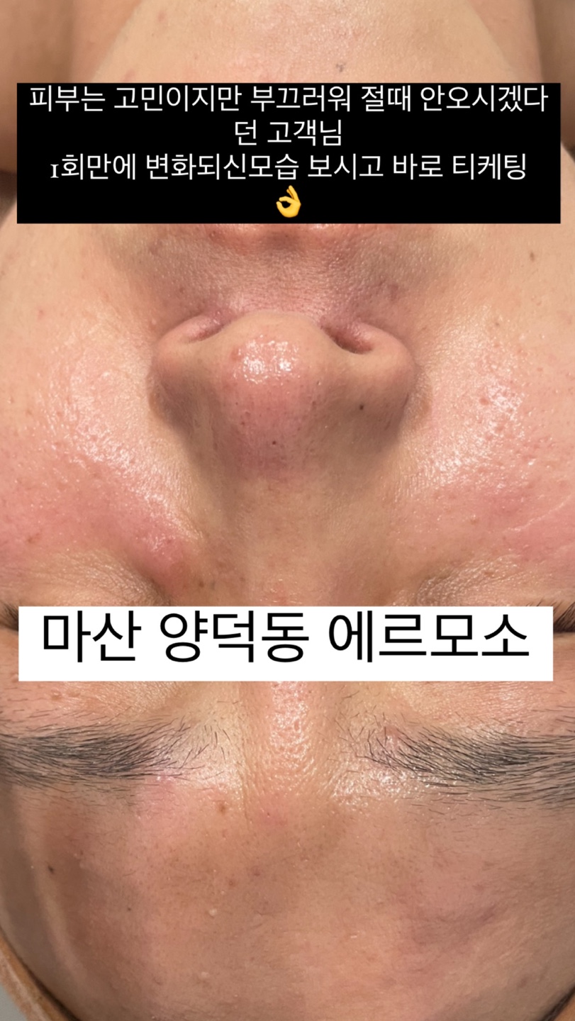 에르모소, 아름다운피부 photo 7