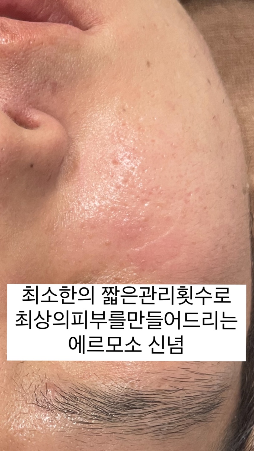 에르모소, 아름다운피부 photo 10