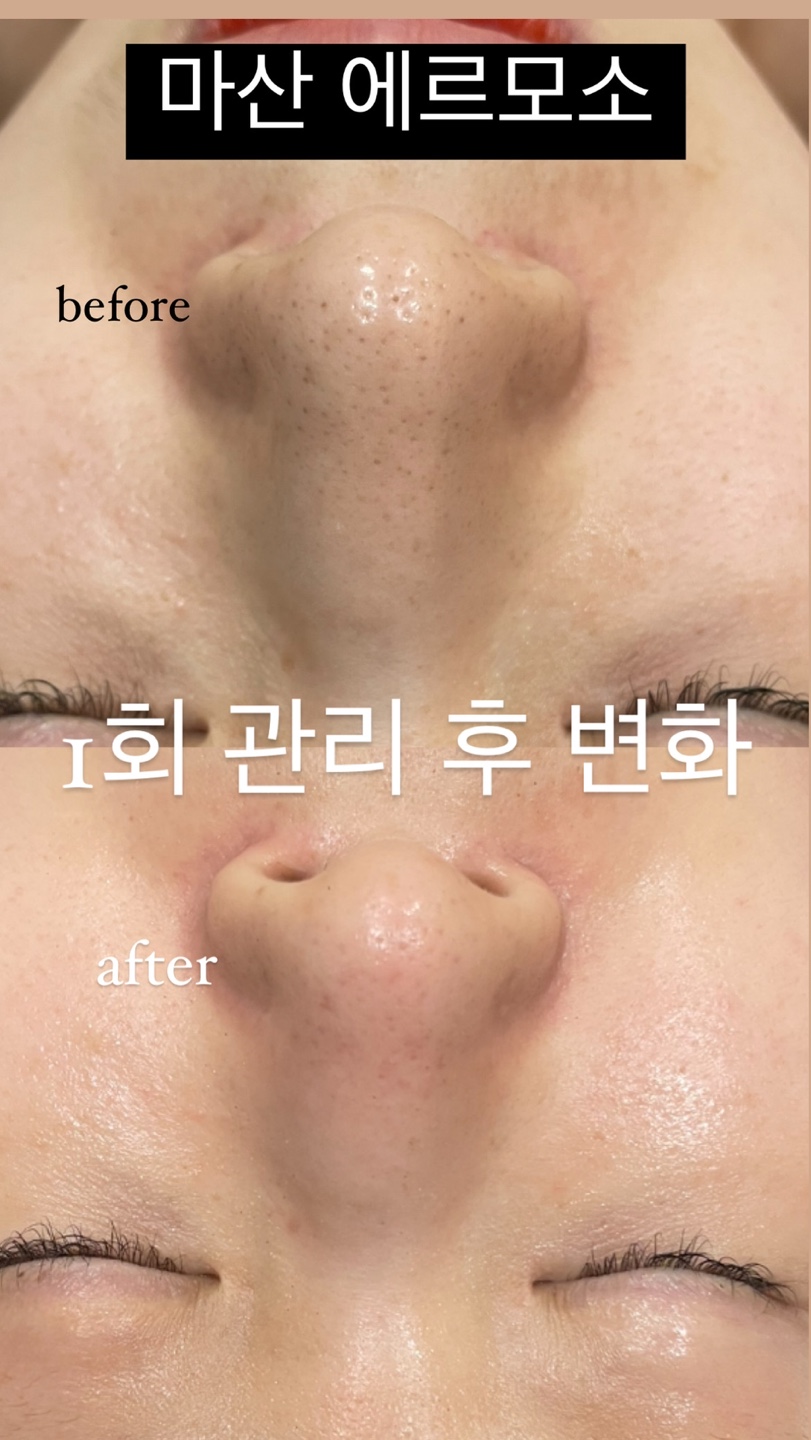 에르모소, 아름다운피부 photo 8