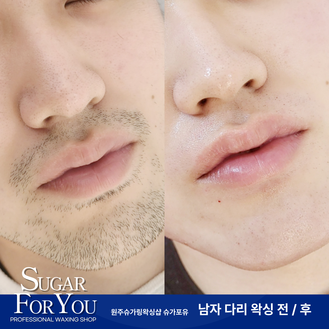 슈가포유