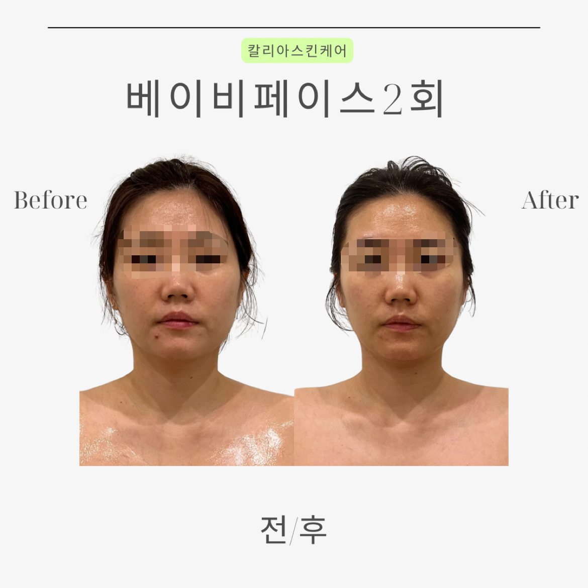 매끄롬 대구죽전점