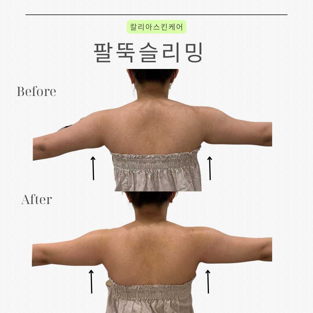 매끄롬 대구죽전점