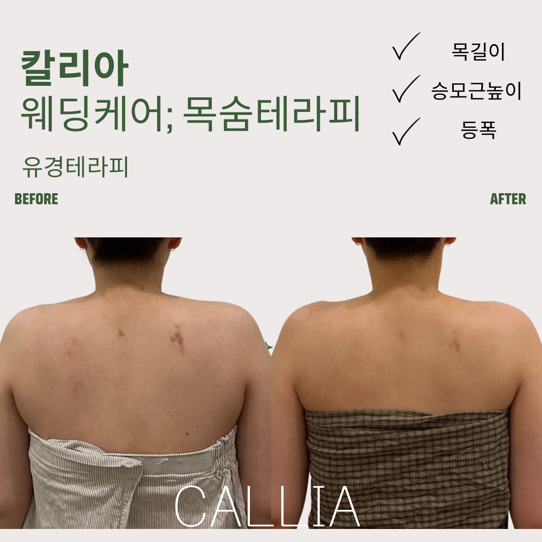 매끄롬 대구죽전점