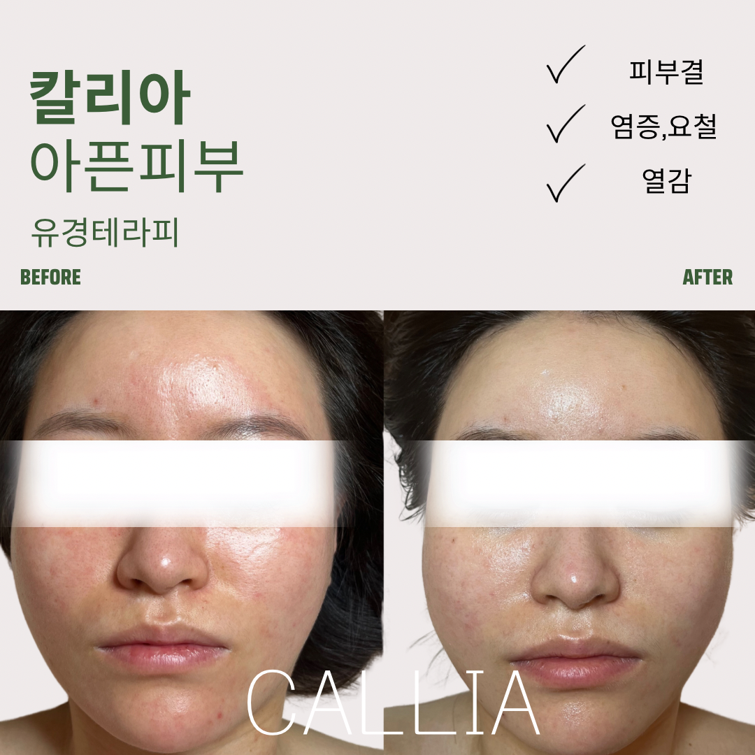 매끄롬 대구죽전점