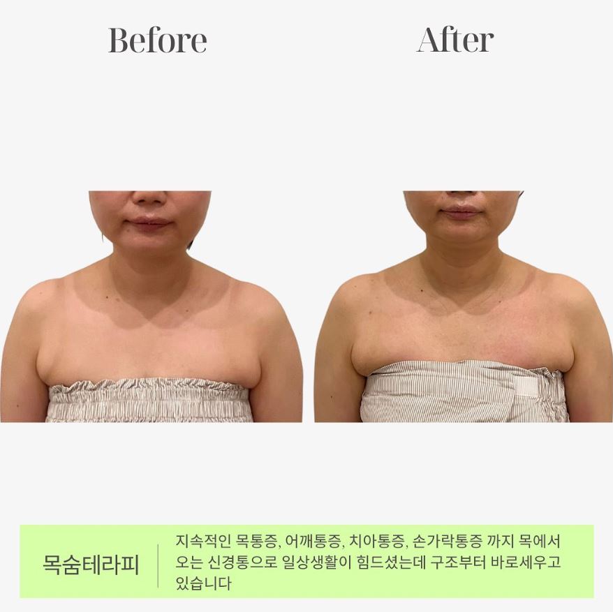 매끄롬 대구죽전점