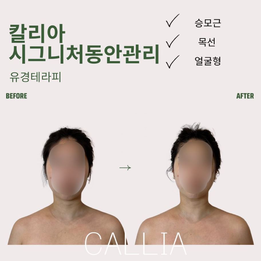 매끄롬 대구죽전점