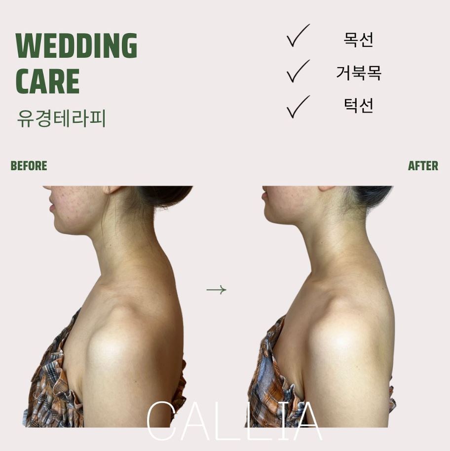 매끄롬 대구죽전점