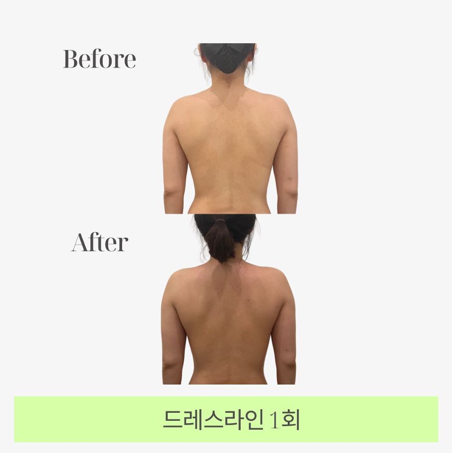 매끄롬 대구죽전점