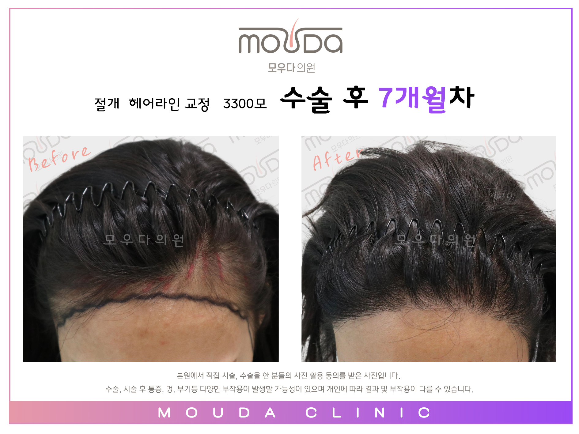 모우다의원 대표 이미지