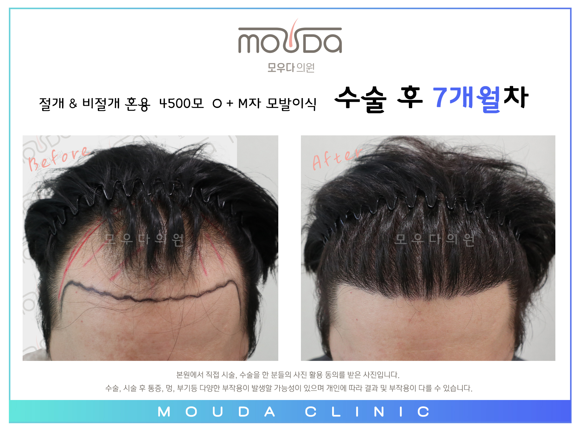모우다의원