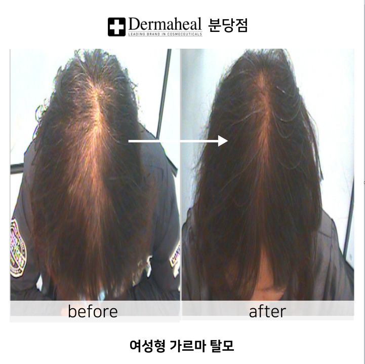 엠지에프두피탈모전문센터 분당야탑점 대표 이미지