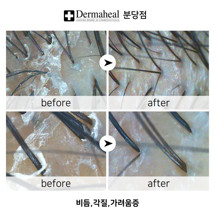 엠지에프두피탈모 센터 이미지