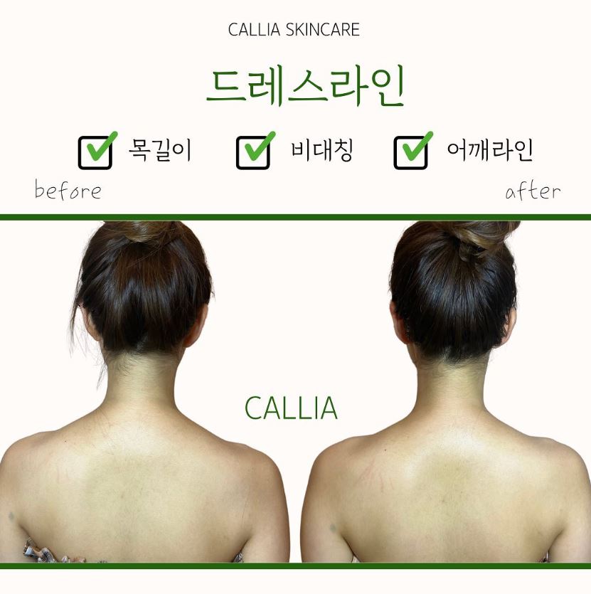 매끄롬 대구죽전점