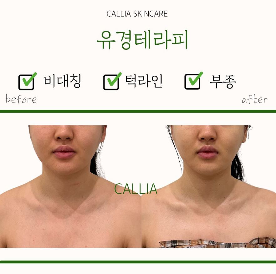 매끄롬 대구죽전점