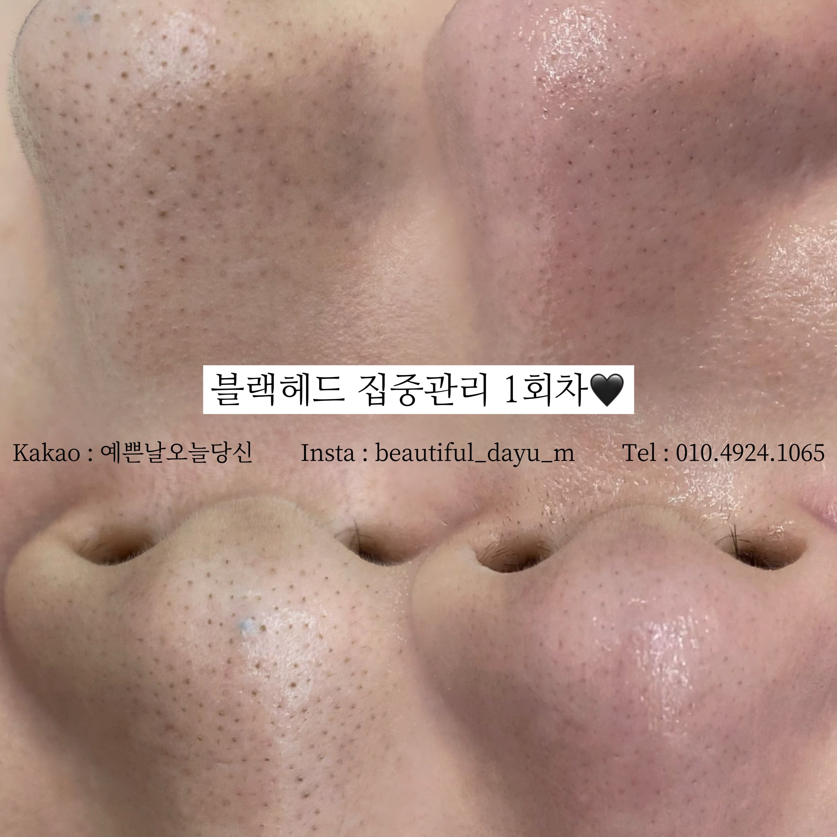 예쁜날 오늘당신