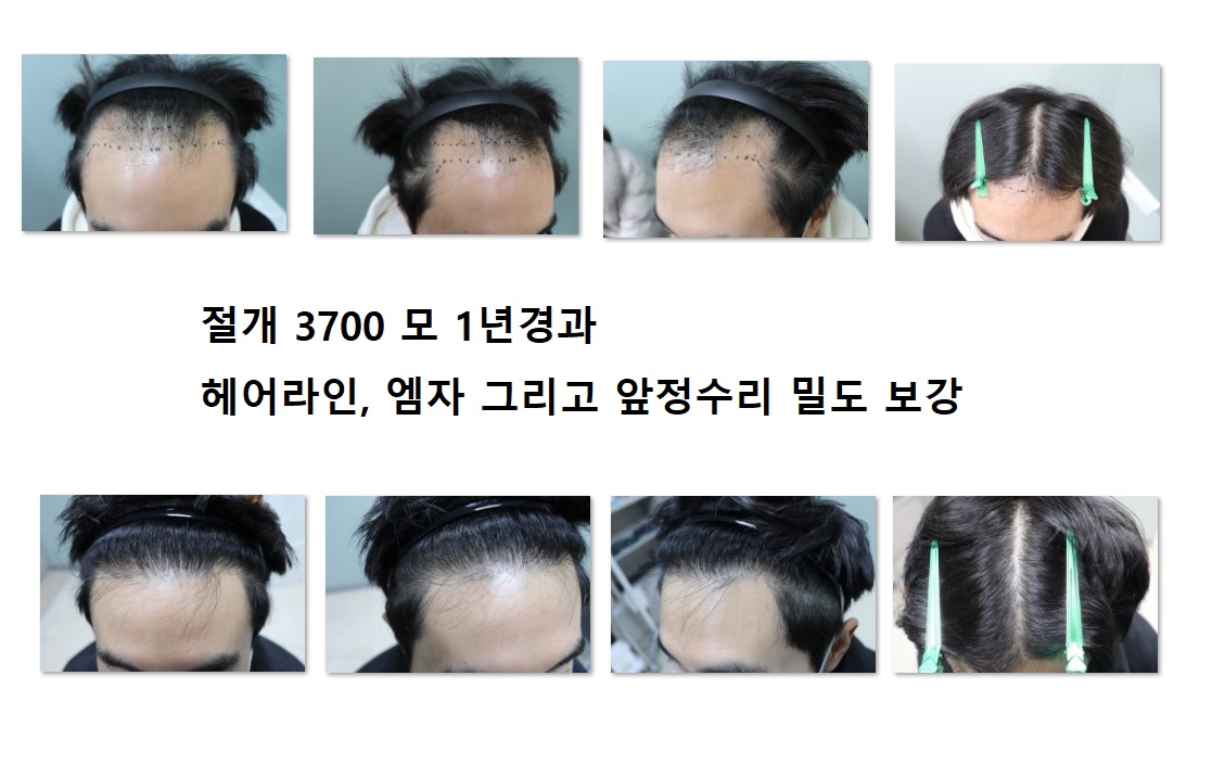 에이치헤어의원