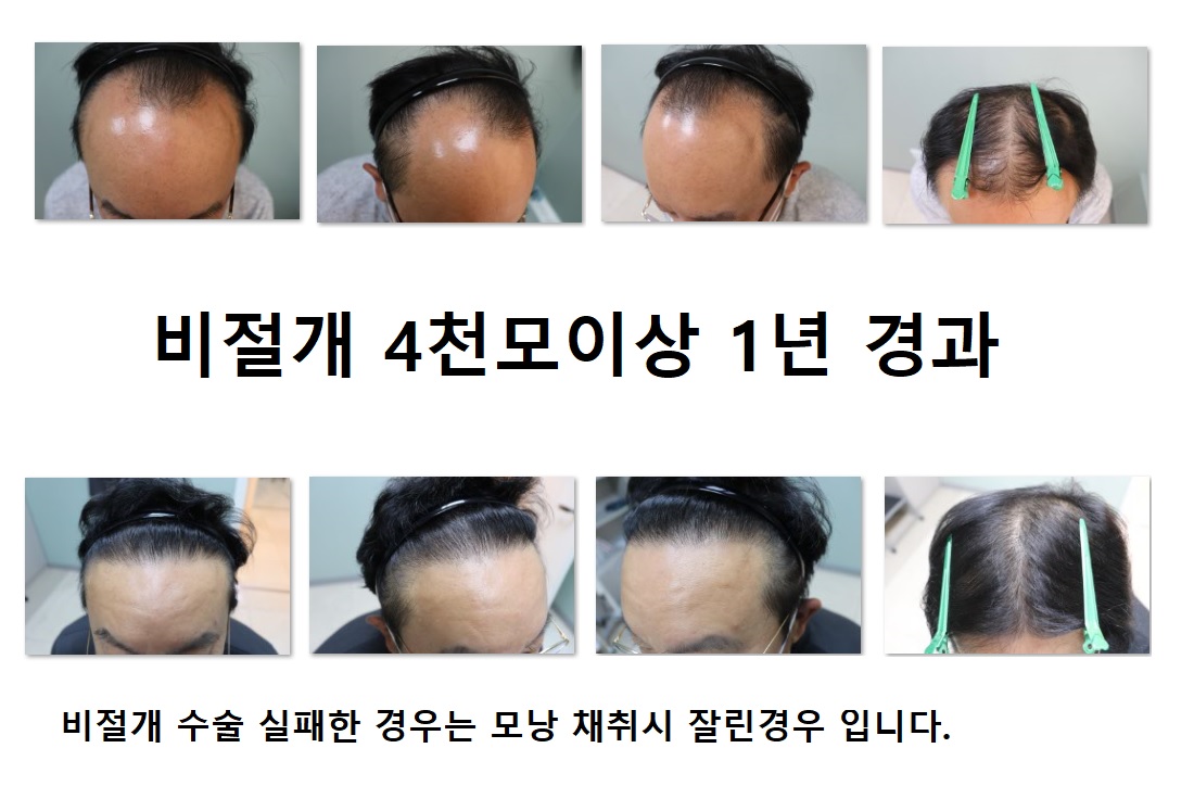 에이치헤어의원 대표 이미지