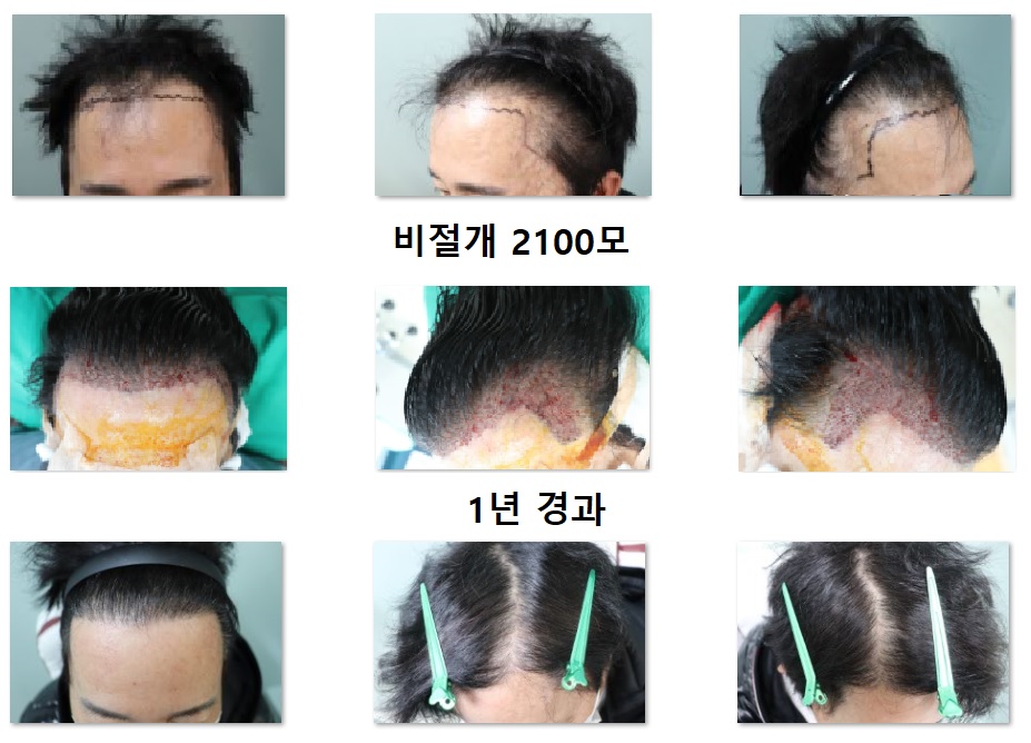 에이치헤어의원 대표 이미지