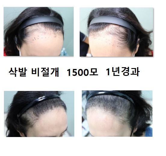 에이치헤어의원 대표 이미지