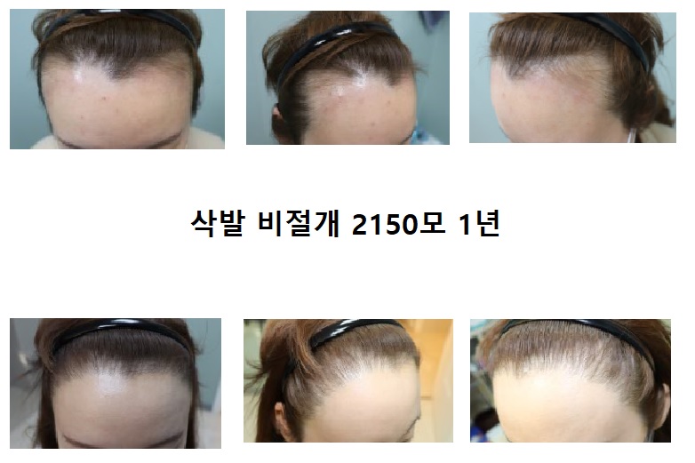 에이치헤어의원 대표 이미지