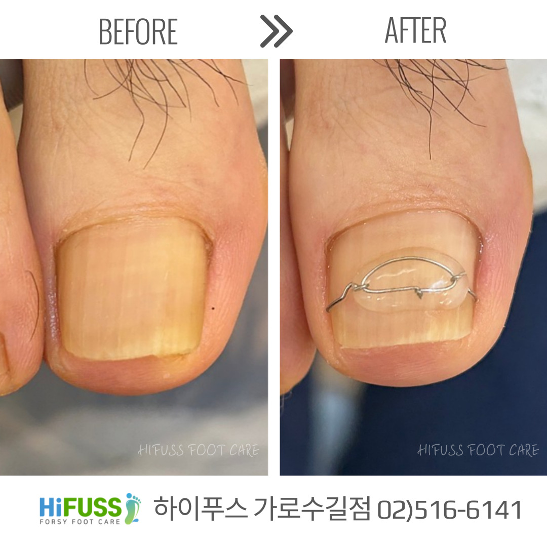 포쉬네일 하이푸스 가로수길점
